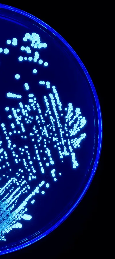 Legionella bacteria culture on laboratory dish